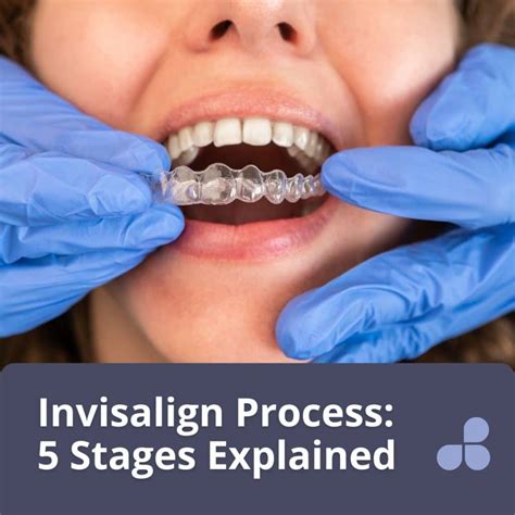 invisalign skanderborg|Invisalign treatment .